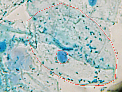 Outlined Cell and Nucleus