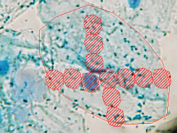 How Many Nuclei?