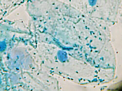 Buccal Smear