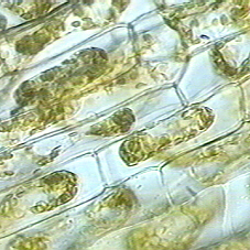 plasmolysis in Elodea