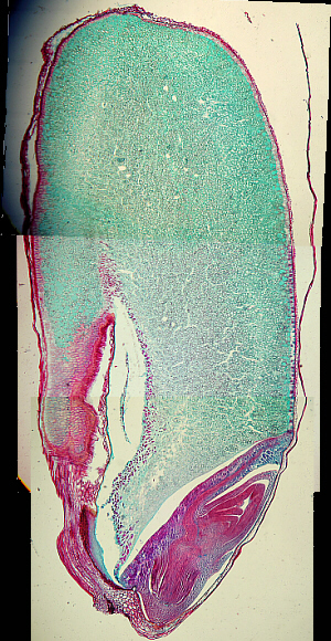 wheat seed x.s. under microscope