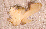 First Maxilla