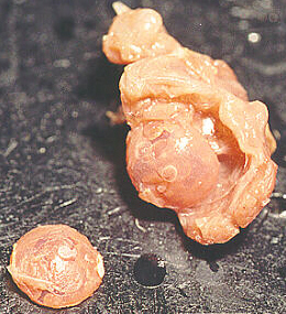 Opened Gizzard with Grinding Structure
