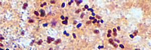 gram positive