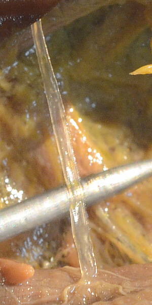 lubber female one tracheal tube