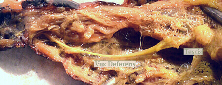 lubber male right testis