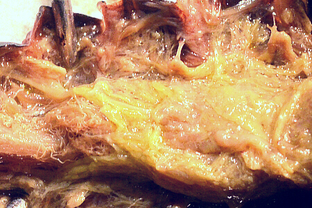 lubber male Malpighian tubules