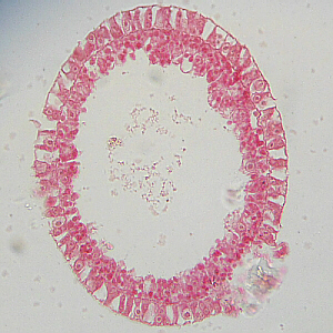 Hydra, cross section