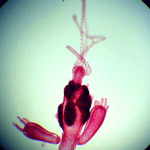 Hydra with spermaries