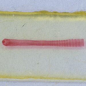 anterior segments and scolex