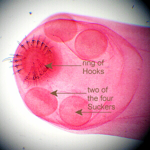 labeled tapeworm scolex