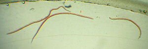 males and females
