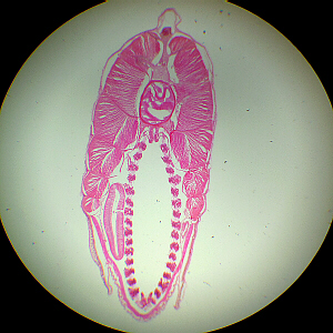 amphioxus xs