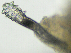 Eyelash Mite