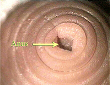 worm anus