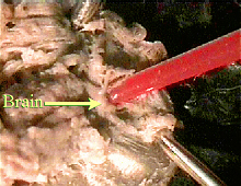 worm brain