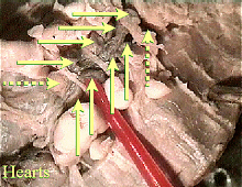 worm hearts