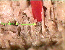 worm nephridia