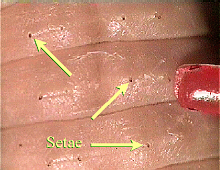 worm setae
