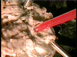 worm brain