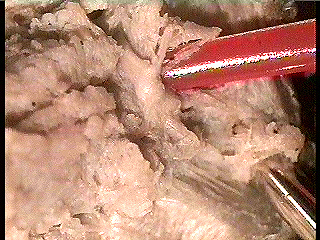 worm brain