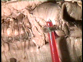 worm dorsal blood vessel