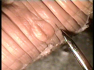worm genitalia