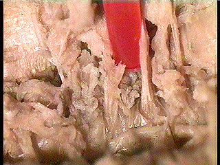worm nephridia