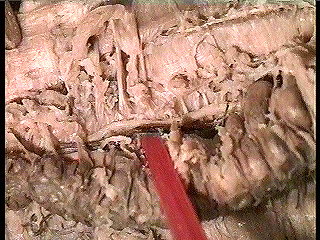 worm ventral nerve cord