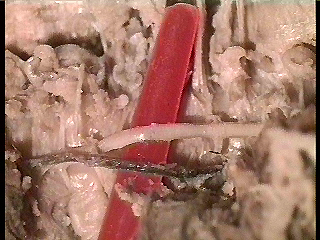 worm ventral nerve cord and blood vessel