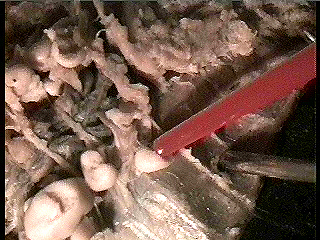 worm seminal vesicles and receptacles