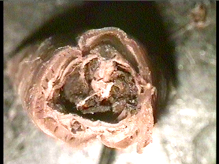 intestinal cross section of whole worm