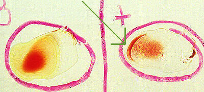 Agglutination