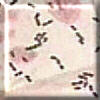 Pneumonia