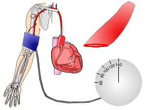 Pressure = 140, no blood flow