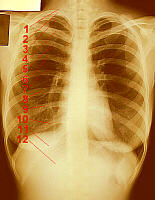 Female Ribs
