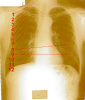 Male Ribs